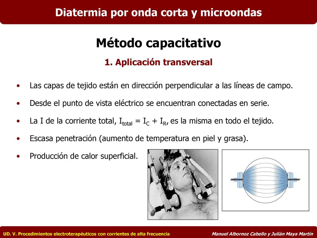 Diatermia por onda corta y microondas 1. Aplicación transversal