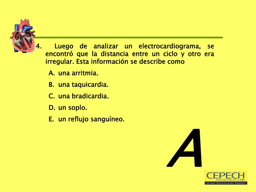 4. Luego de analizar un electrocardiograma, se encontró que la distancia entre un ciclo y otro era irregular. Esta información se describe como