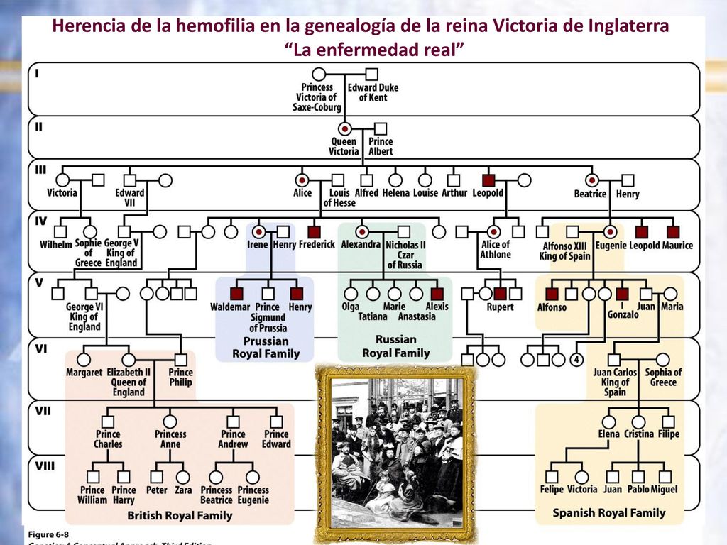 Herencia de la hemofilia en la genealogía de la reina Victoria de Inglaterra