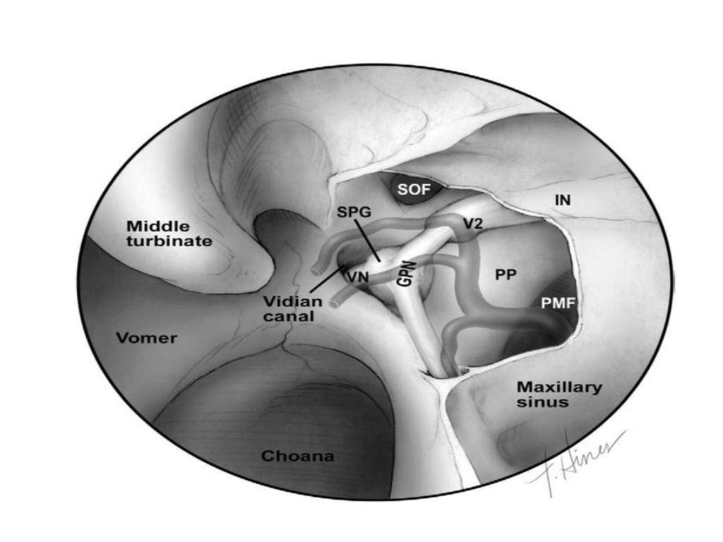 Vista por fosa nasal izquierda: se removio pared medial y posterior de seno maxilar.