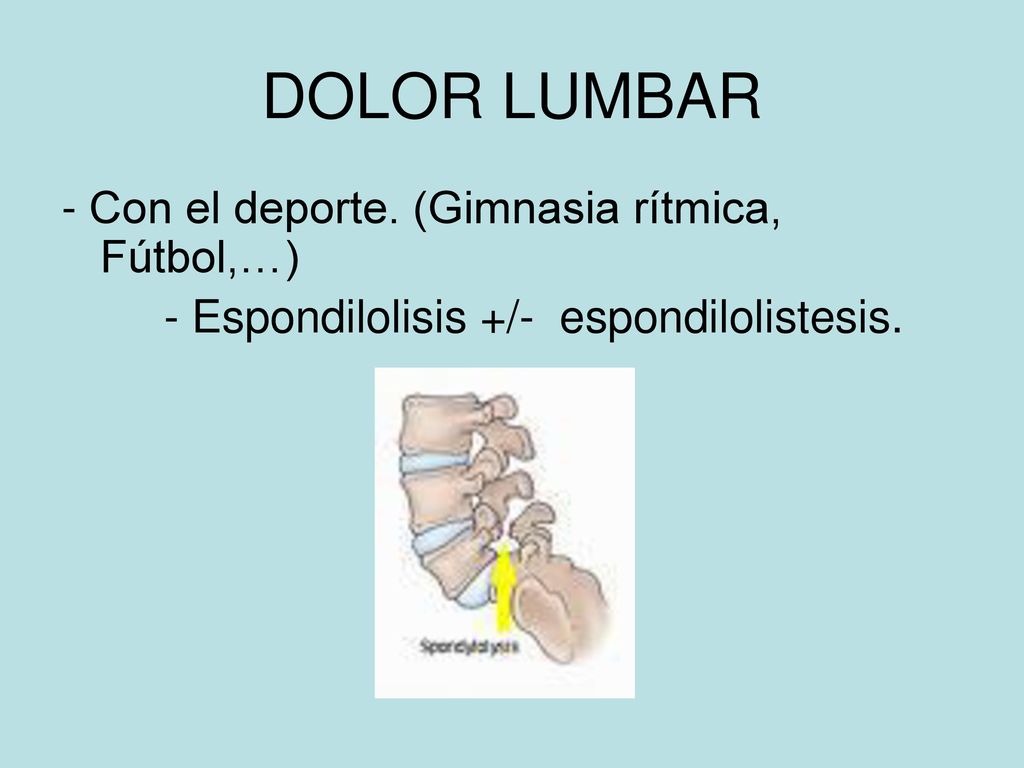 DOLOR LUMBAR - Con el deporte. (Gimnasia rítmica, Fútbol,…)