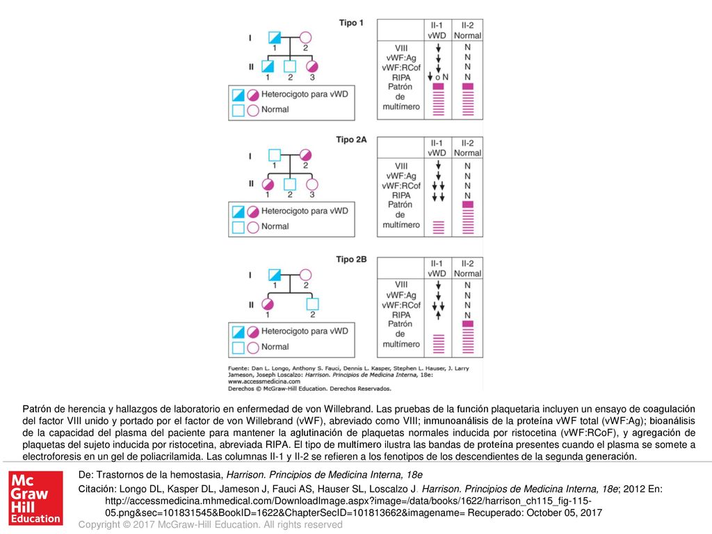 Patrón de herencia y hallazgos de laboratorio en enfermedad de von Willebrand. Las pruebas de la función plaquetaria incluyen un ensayo de coagulación del factor VIII unido y portado por el factor de von Willebrand (vWF), abreviado como VIII; inmunoanálisis de la proteína vWF total (vWF:Ag); bioanálisis de la capacidad del plasma del paciente para mantener la aglutinación de plaquetas normales inducida por ristocetina (vWF:RCoF), y agregación de plaquetas del sujeto inducida por ristocetina, abreviada RIPA. El tipo de multímero ilustra las bandas de proteína presentes cuando el plasma se somete a electroforesis en un gel de poliacrilamida. Las columnas II-1 y II-2 se refieren a los fenotipos de los descendientes de la segunda generación.