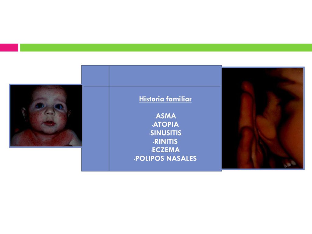 Historia familiar ASMA ATOPIA SINUSITIS RINITIS ECZEMA POLIPOS NASALES