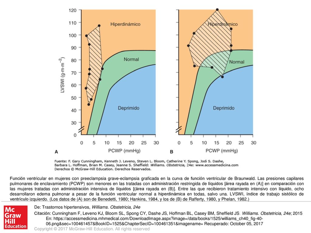 Función ventricular en mujeres con preeclampsia grave-eclampsia graficada en la curva de función ventricular de Braunwald. Las presiones capilares pulmonares de enclavamiento (PCWP) son menores en las tratadas con administración restringida de líquidos [área rayada en (A)] en comparación con las mujeres tratadas con administración intensiva de líquidos [(área rayada en (B)]. Entre las que recibieron tratamiento intensivo con líquido, ocho desarrollaron edema pulmonar a pesar de la función ventricular normal a hiperdinámica en todas, salvo una. LVSWI, índice de trabajo sistólico de ventrículo izquierdo. (Los datos de (A) son de Benedetti, 1980; Hankins, 1984, y los de (B) de Rafferty, 1980, y Phelan, 1982.)