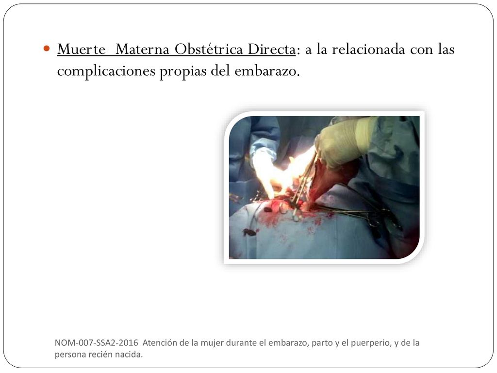 Muerte Materna Obstétrica Directa: a la relacionada con las complicaciones propias del embarazo.