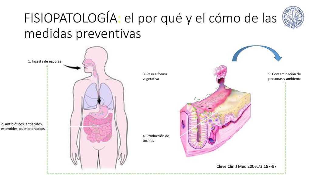 FISIOPATOLOGÍA: el por qué y el cómo de las medidas preventivas