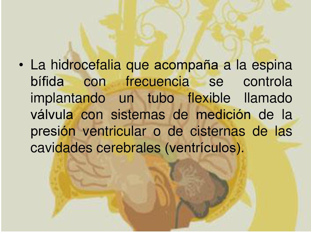 La hidrocefalia que acompaña a la espina bífida con frecuencia se controla implantando un tubo flexible llamado válvula con sistemas de medición de la presión ventricular o de cisternas de las cavidades cerebrales (ventrículos).