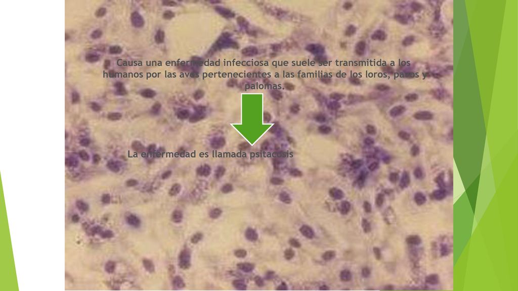 Causa una enfermedad infecciosa que suele ser transmitida a los humanos por las aves pertenecientes a las familias de los loros, pavos y palomas.