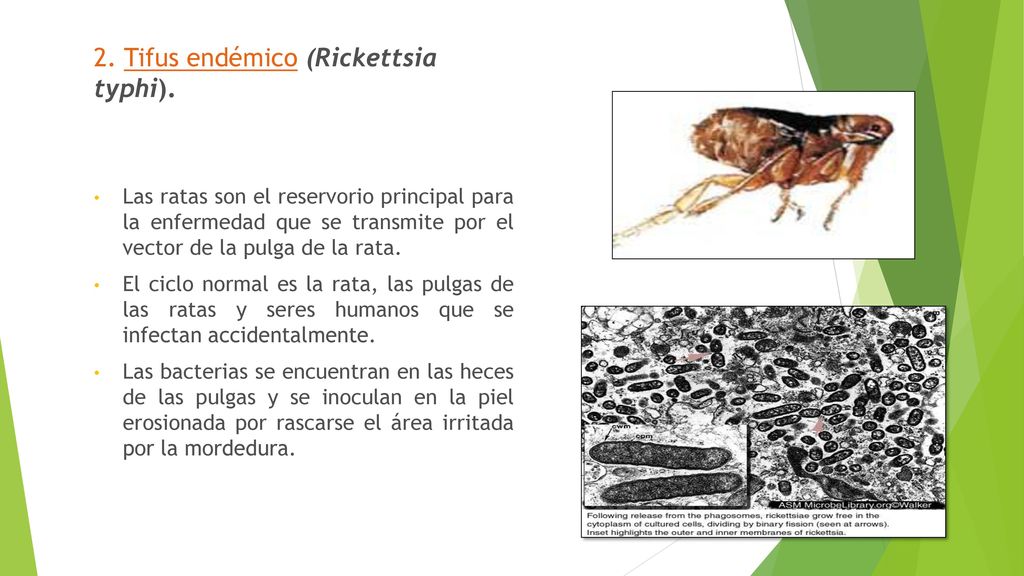 2. Tifus endémico (Rickettsia typhi).