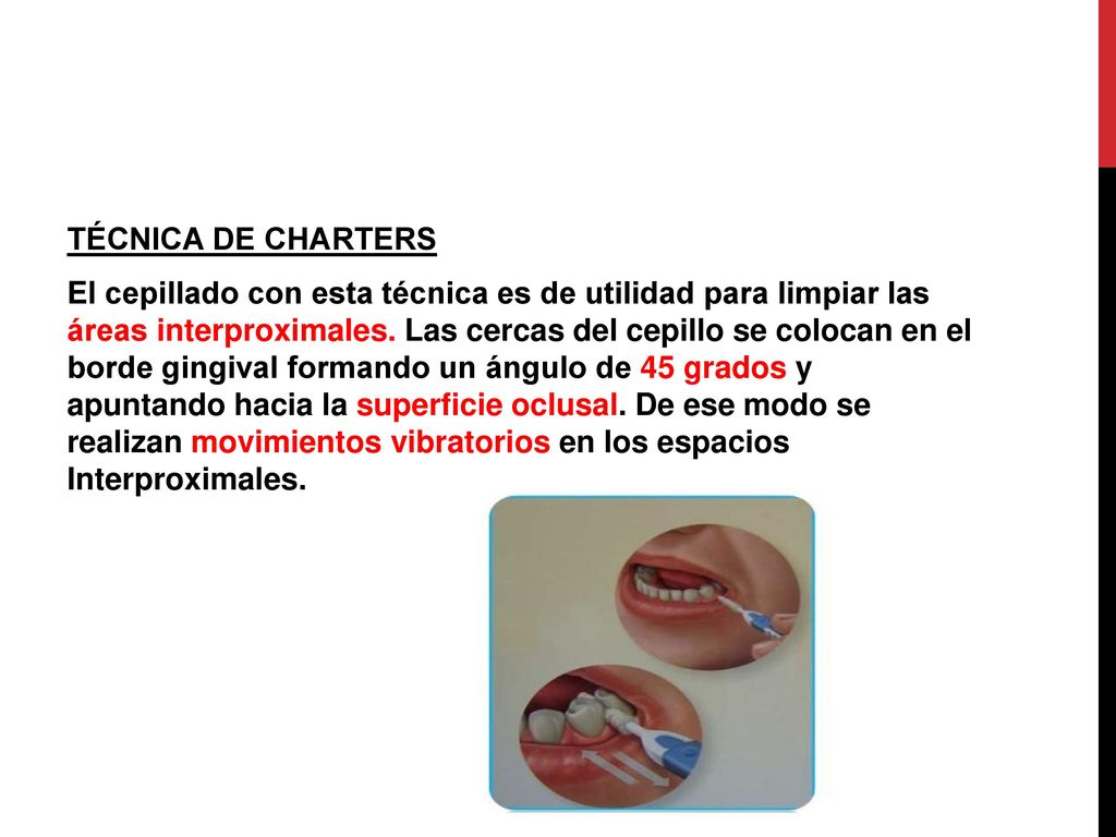 TÉCNICA DE CHARTERS El cepillado con esta técnica es de utilidad para limpiar las áreas interproximales.