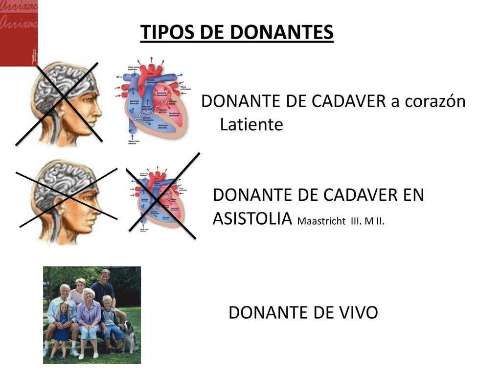 TIPOS DE DONANTES DONANTE DE CADAVER a corazón Latiente