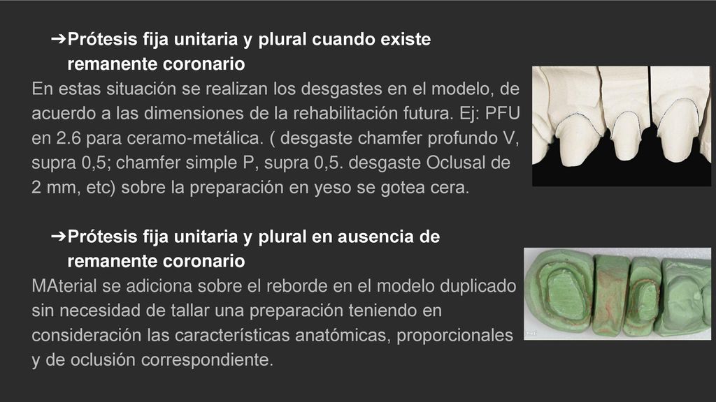 Prótesis fija unitaria y plural cuando existe remanente coronario