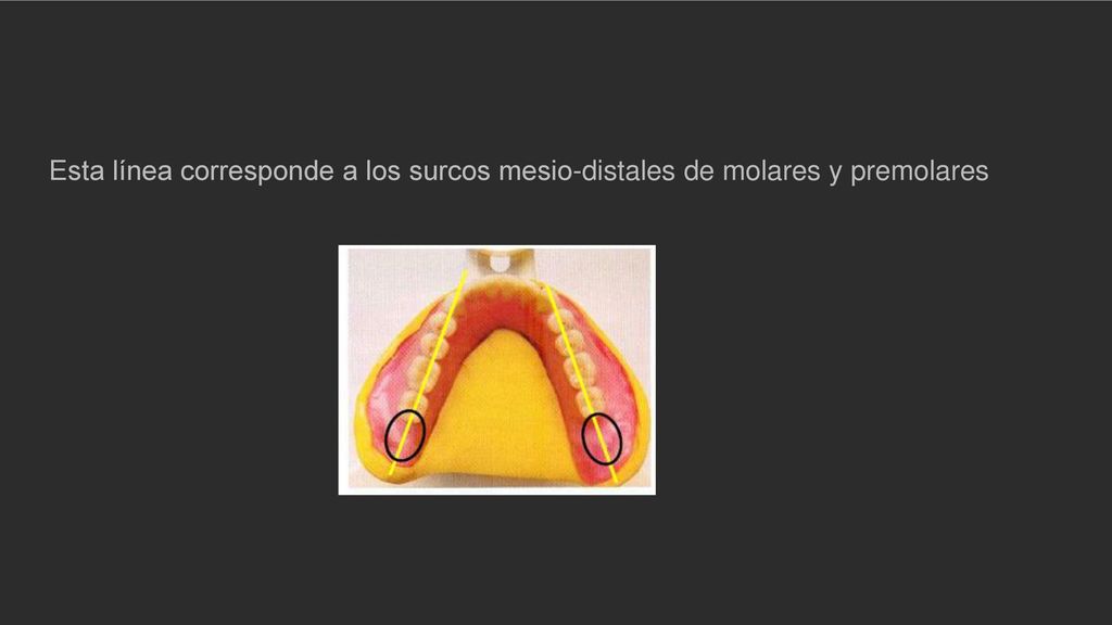 Esta línea corresponde a los surcos mesio-distales de molares y premolares