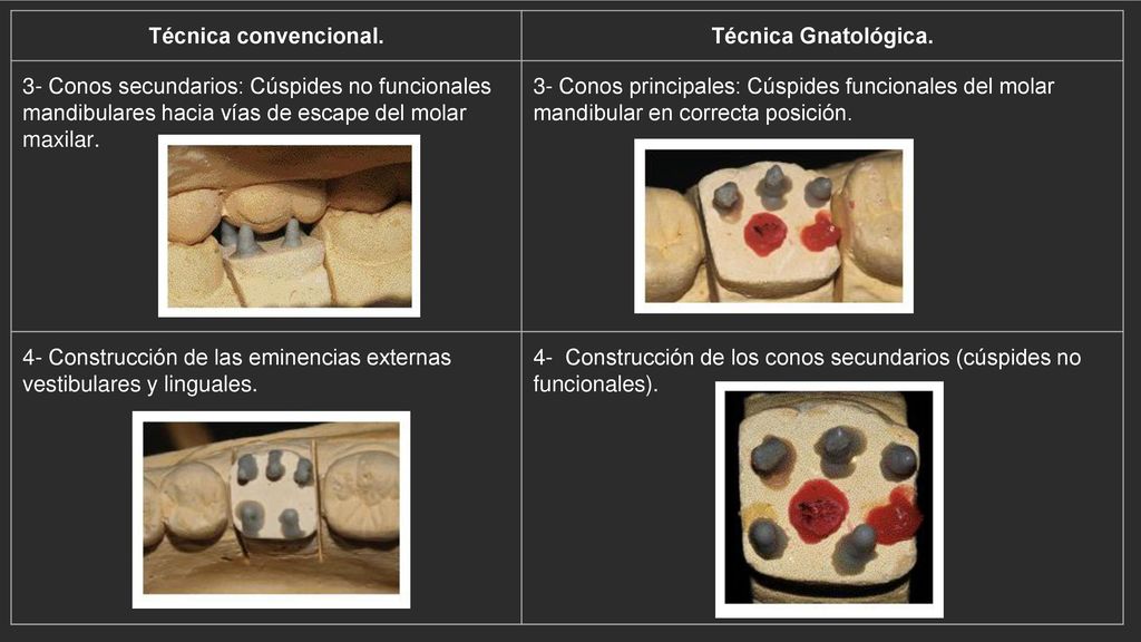 Técnica convencional. Técnica Gnatológica. 3- Conos secundarios: Cúspides no funcionales mandibulares hacia vías de escape del molar maxilar.
