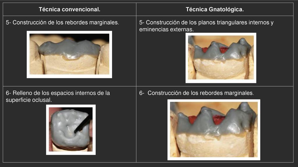 Técnica convencional. Técnica Gnatológica. 5- Construcción de los rebordes marginales.
