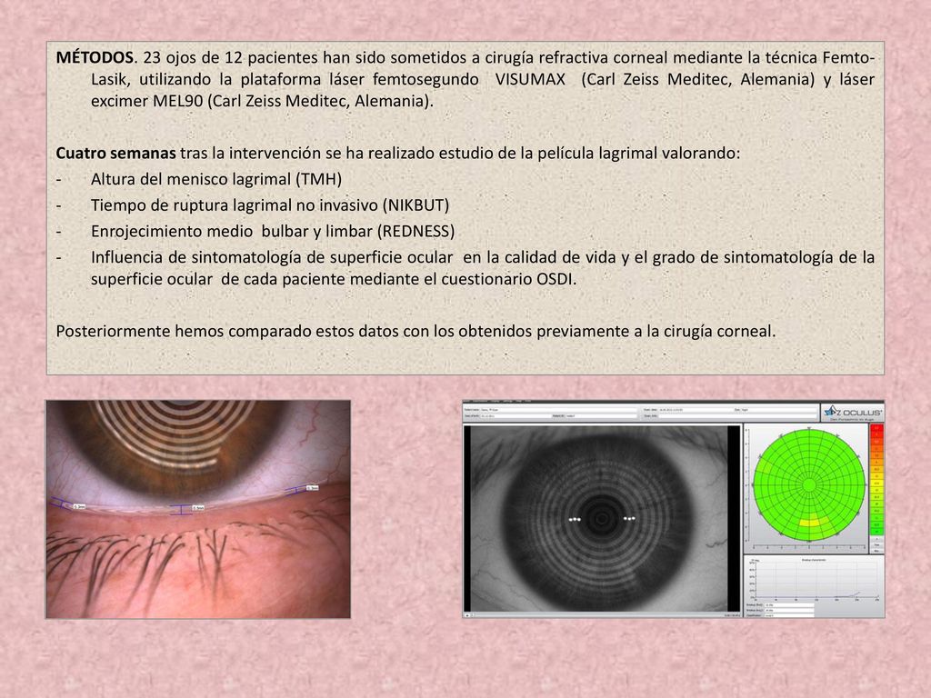 MÉTODOS. 23 ojos de 12 pacientes han sido sometidos a cirugía refractiva corneal mediante la técnica Femto-Lasik, utilizando la plataforma láser femtosegundo VISUMAX (Carl Zeiss Meditec, Alemania) y láser excimer MEL90 (Carl Zeiss Meditec, Alemania).
