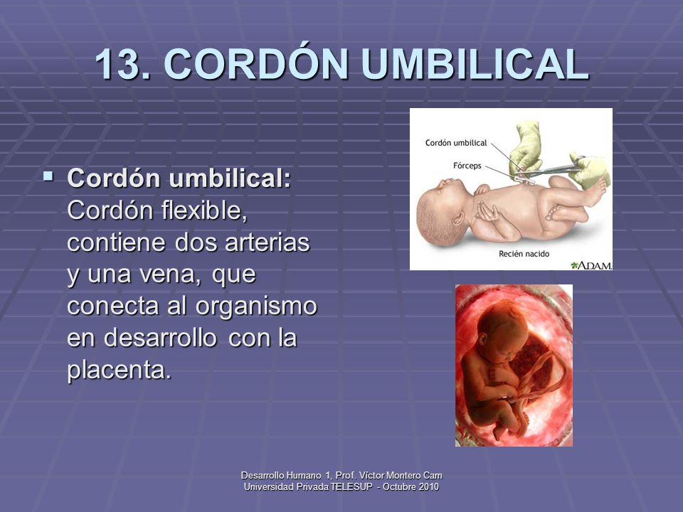 13. CORDÓN UMBILICAL Cordón umbilical: Cordón flexible, contiene dos arterias y una vena, que conecta al organismo en desarrollo con la placenta.