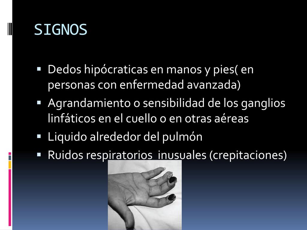 SIGNOS Dedos hipócraticas en manos y pies( en personas con enfermedad avanzada)