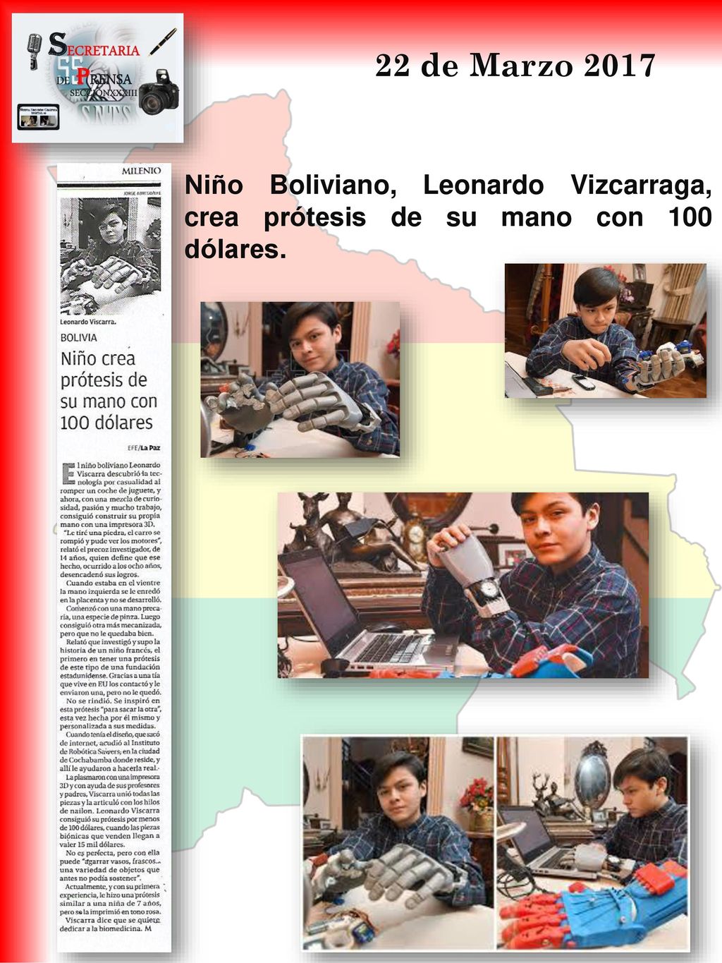 22 de Marzo 2017 Niño Boliviano, Leonardo Vizcarraga, crea prótesis de su mano con 100 dólares.