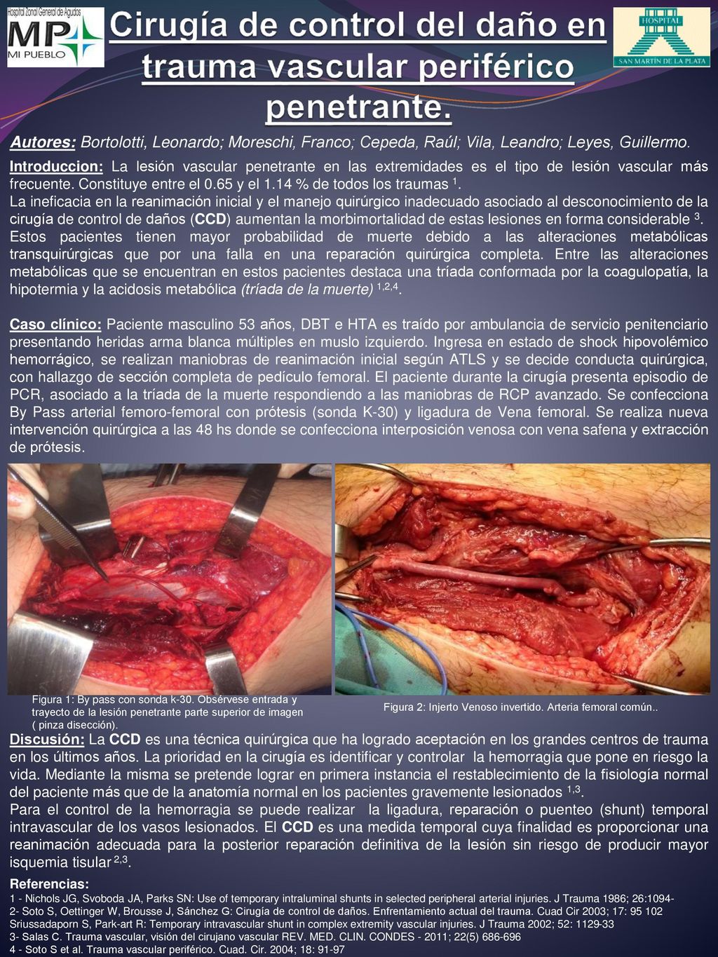 Cirugía de control del daño en trauma vascular periférico penetrante.