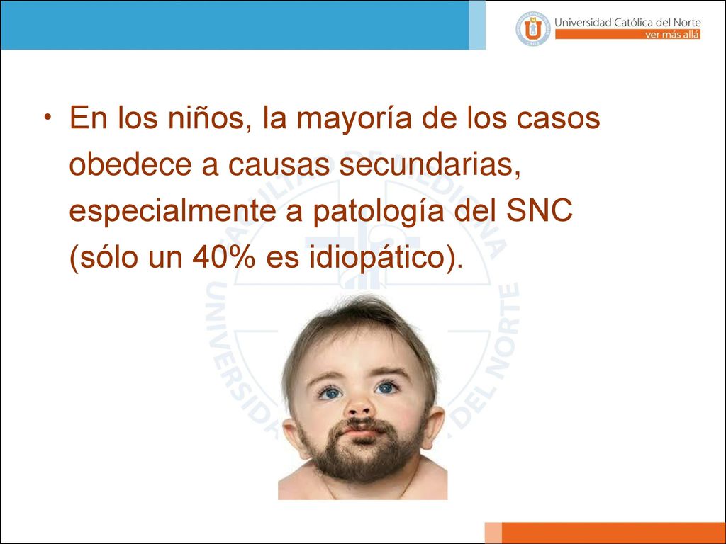 En los niños, la mayoría de los casos obedece a causas secundarias, especialmente a patología del SNC (sólo un 40% es idiopático).