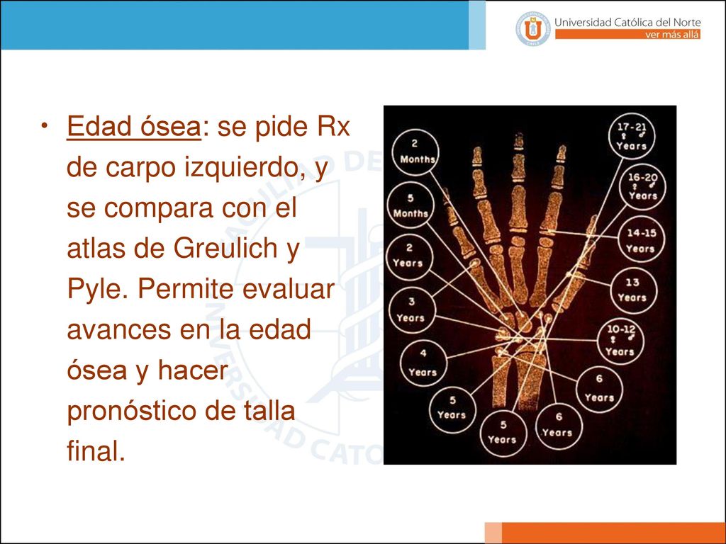 Edad ósea: se pide Rx de carpo izquierdo, y se compara con el atlas de Greulich y Pyle.