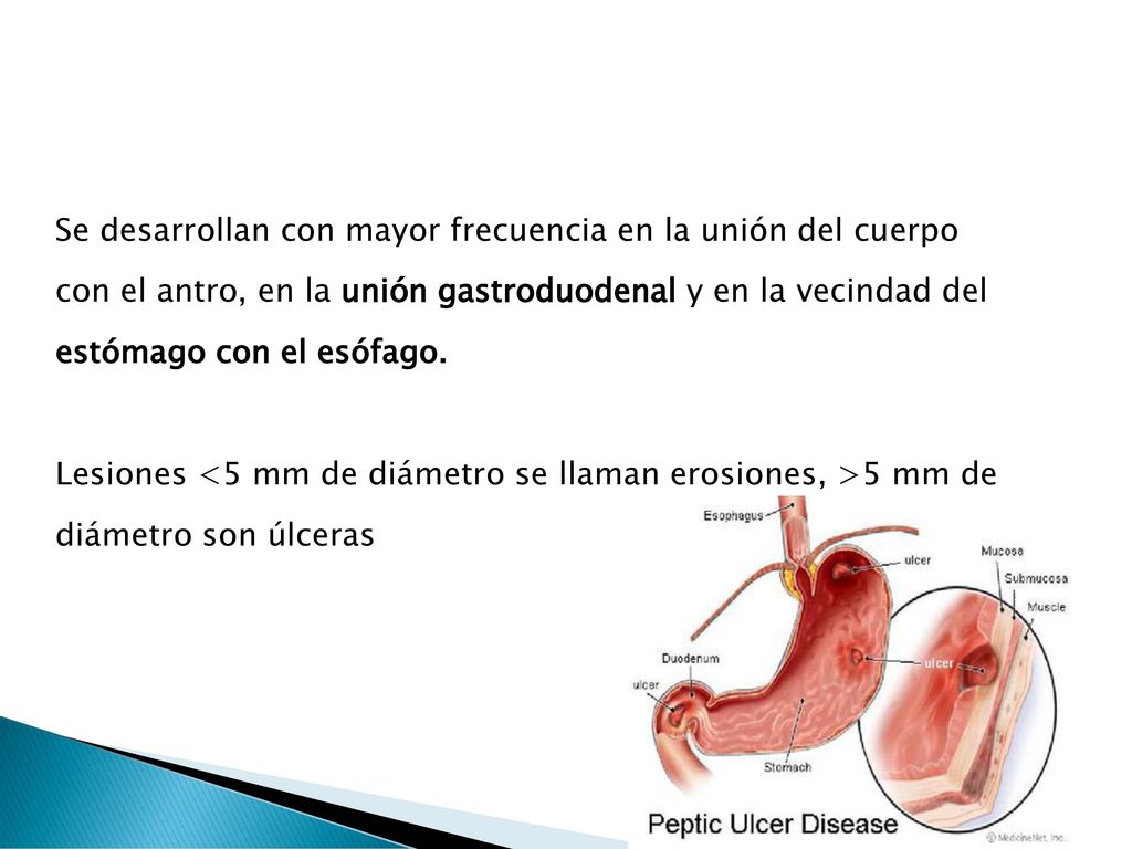 Se desarrollan con mayor frecuencia en la unión del cuerpo