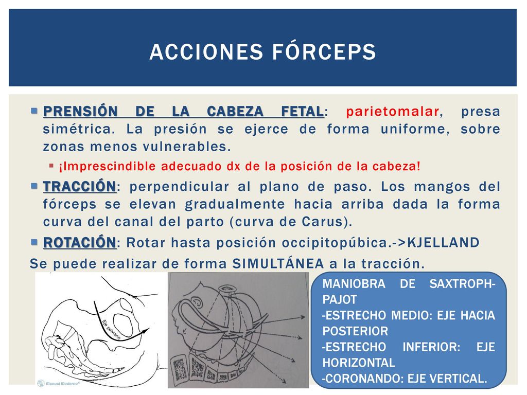 Acciones fórceps PRENSIÓN DE LA CABEZA FETAL: parietomalar, presa simétrica. La presión se ejerce de forma uniforme, sobre zonas menos vulnerables.