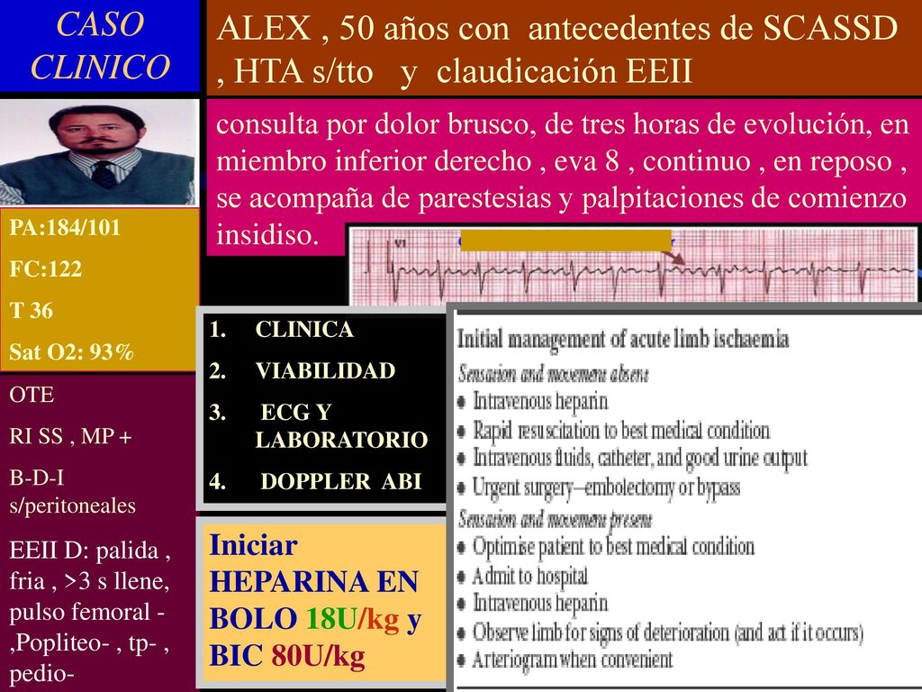 CASO CLINICO ALEX , 50 años con antecedentes de SCASSD , HTA s/tto y claudicación EEII.