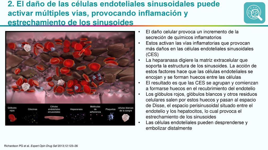 2. El daño de las células endoteliales sinusoidales puede activar múltiples vías, provocando inflamación y estrechamiento de los sinusoides