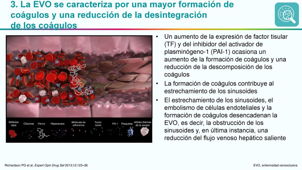 3. La EVO se caracteriza por una mayor formación de coágulos y una reducción de la desintegración de los coágulos