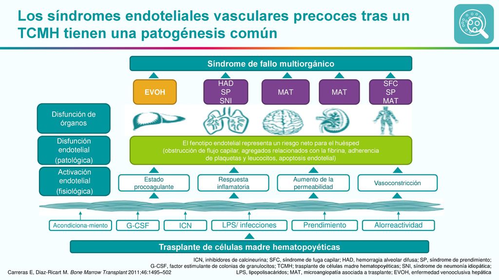 Los síndromes endoteliales vasculares precoces tras un TCMH tienen una patogénesis común