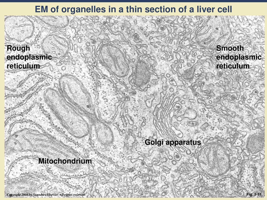 EM of organelles in a thin section of a liver cell