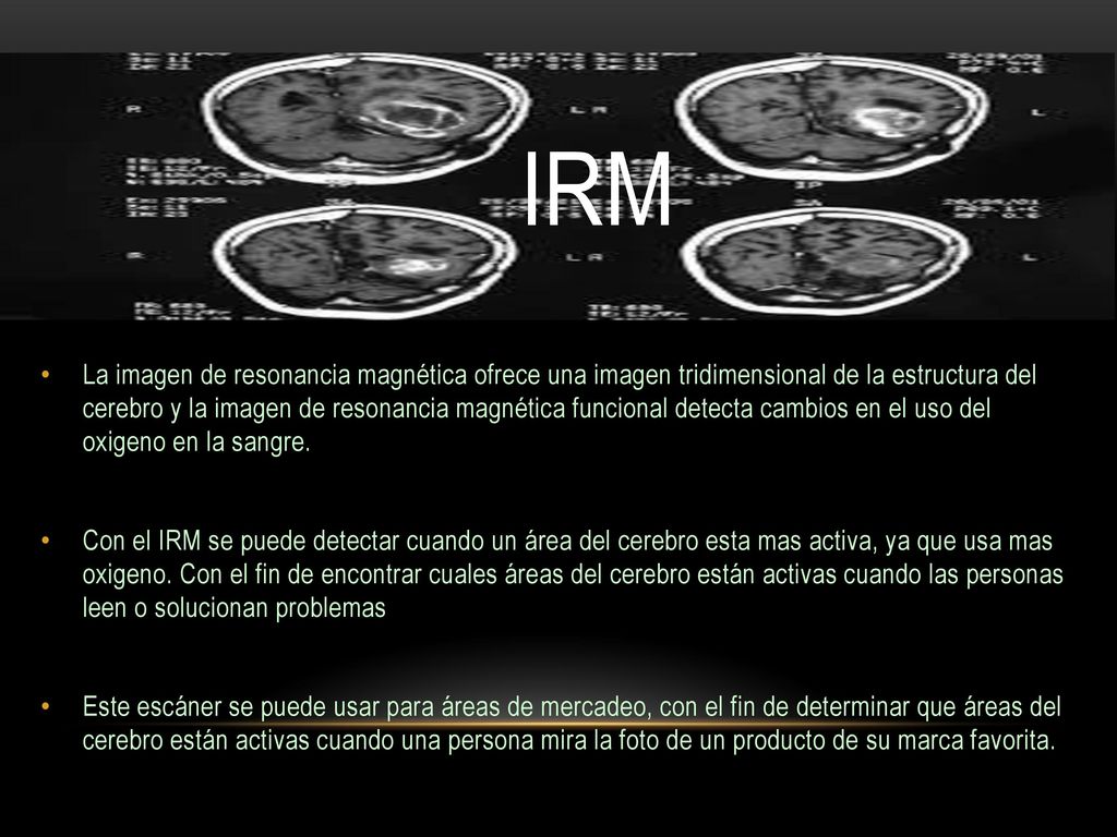 IRM