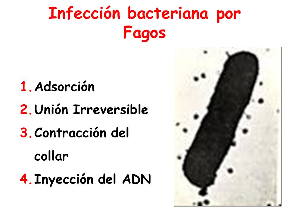 Infección bacteriana por Fagos