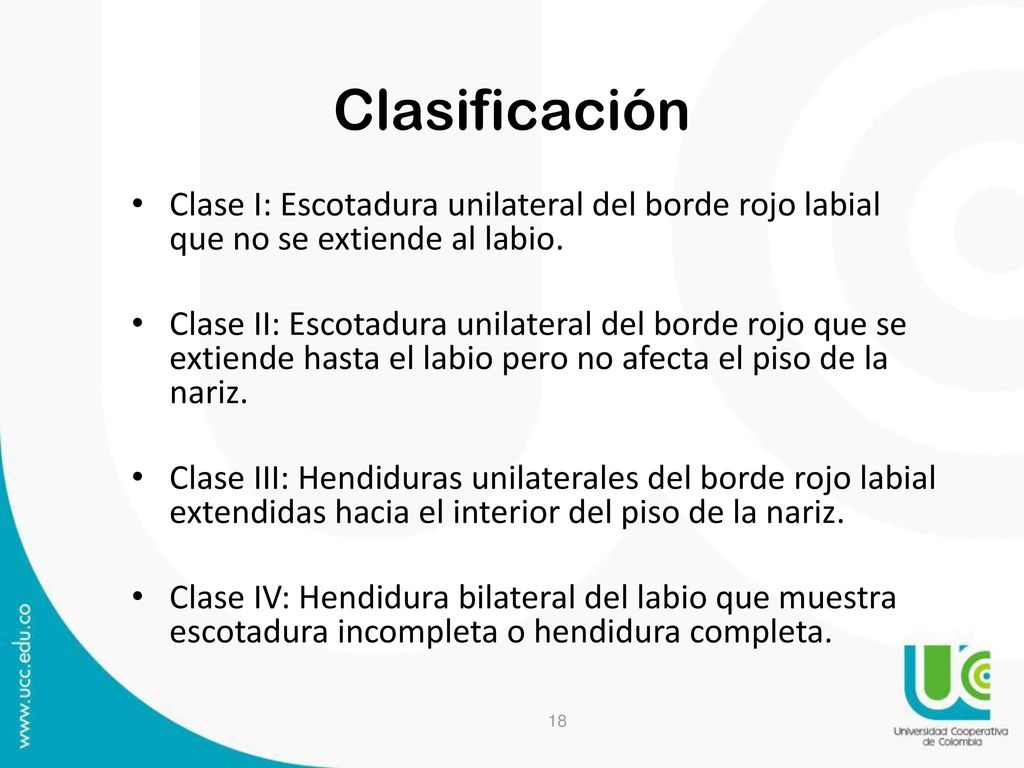 Clasificación Clase I: Escotadura unilateral del borde rojo labial que no se extiende al labio.