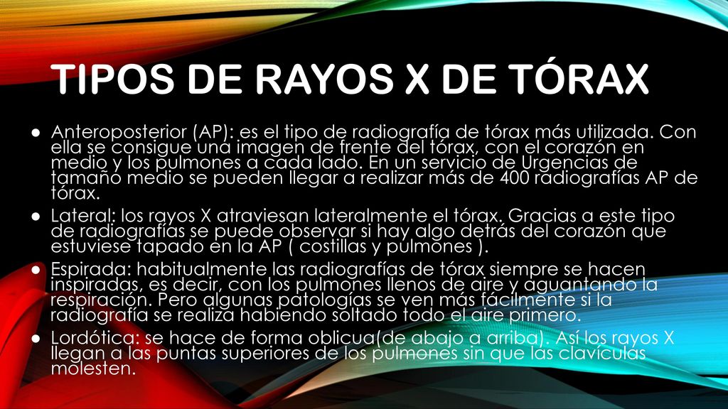 Tipos de rayos x de tórax