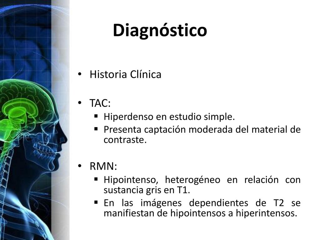 Diagnóstico Historia Clínica TAC: RMN: Hiperdenso en estudio simple.