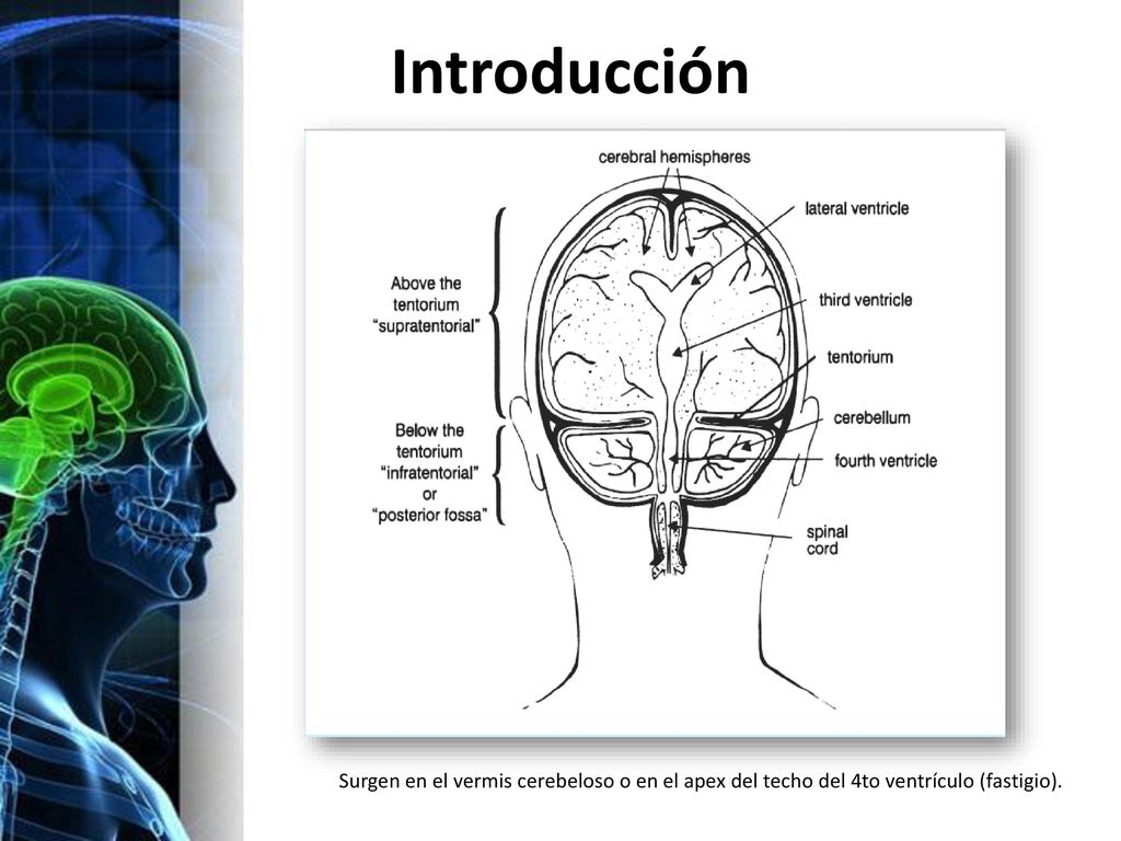 Introducción Surgen en el vermis cerebeloso o en el apex del techo del 4to ventrículo (fastigio).
