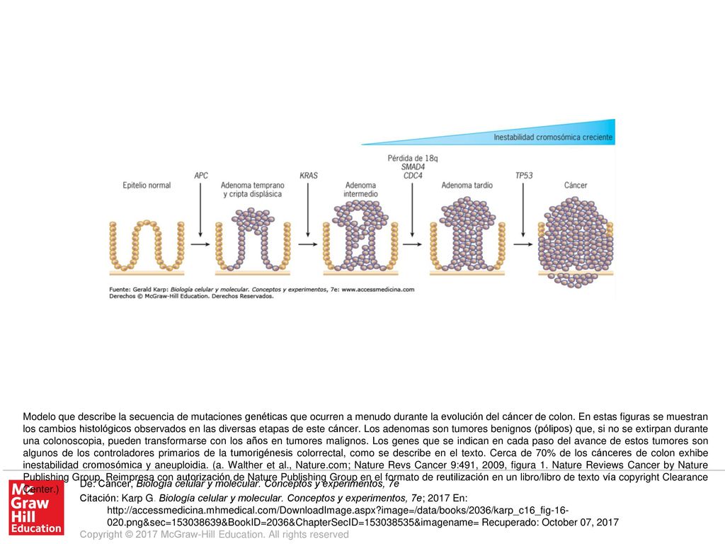 Modelo que describe la secuencia de mutaciones genéticas que ocurren a menudo durante la evolución del cáncer de colon. En estas figuras se muestran los cambios histológicos observados en las diversas etapas de este cáncer. Los adenomas son tumores benignos (pólipos) que, si no se extirpan durante una colonoscopia, pueden transformarse con los años en tumores malignos. Los genes que se indican en cada paso del avance de estos tumores son algunos de los controladores primarios de la tumorigénesis colorrectal, como se describe en el texto. Cerca de 70% de los cánceres de colon exhibe inestabilidad cromosómica y aneuploidia. (a. Walther et al., Nature.com; Nature Revs Cancer 9:491, 2009, figura 1. Nature Reviews Cancer by Nature Publishing Group. Reimpresa con autorización de Nature Publishing Group en el formato de reutilización en un libro/libro de texto vía copyright Clearance Center.)