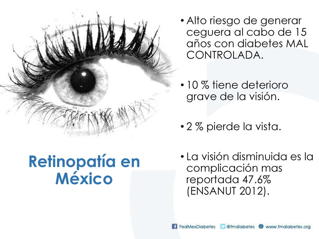 Alto riesgo de generar ceguera al cabo de 15 años con diabetes MAL CONTROLADA.