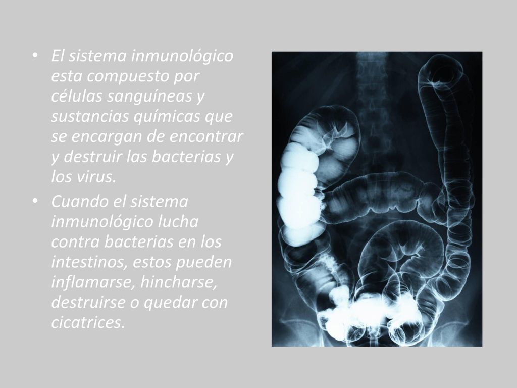 El sistema inmunológico esta compuesto por células sanguíneas y sustancias químicas que se encargan de encontrar y destruir las bacterias y los virus.