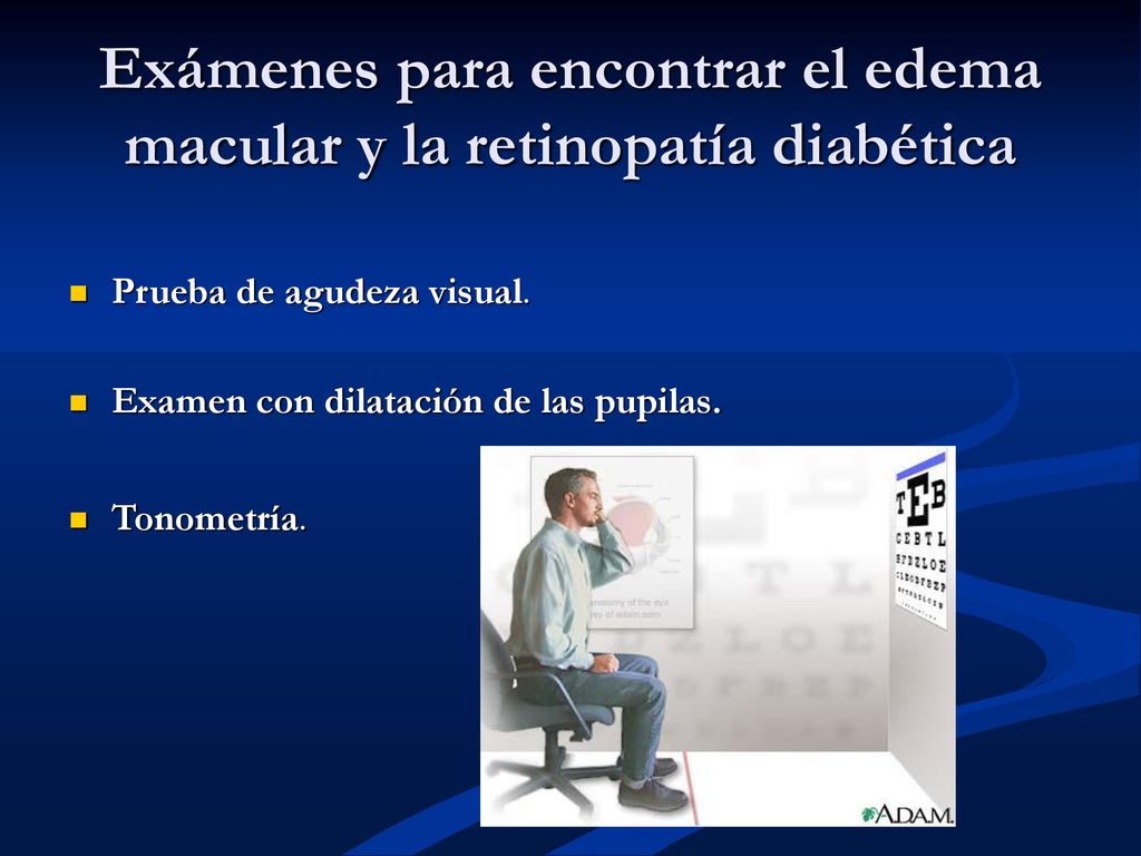 Exámenes para encontrar el edema macular y la retinopatía diabética