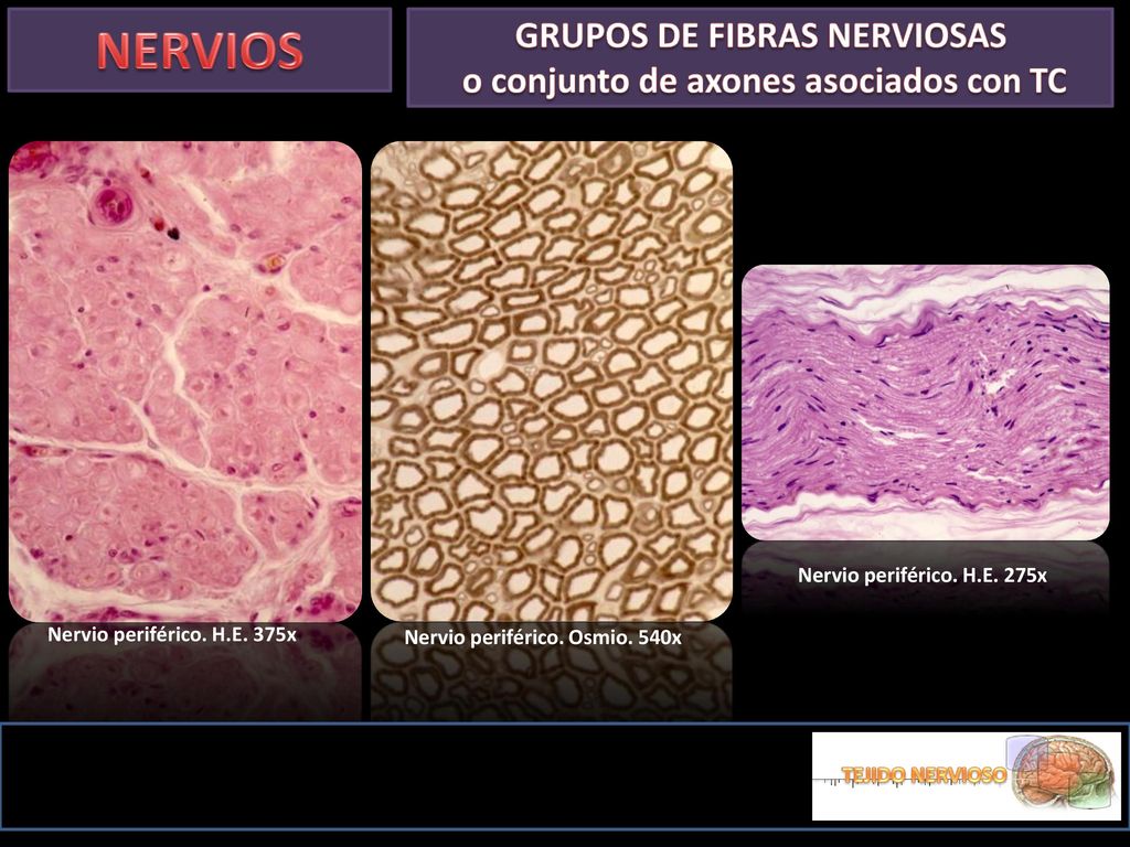 GRUPOS DE FIBRAS NERVIOSAS o conjunto de axones asociados con TC