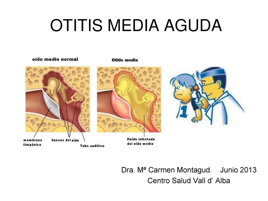Dra. Mª Carmen Montagud. Junio 2013 Centro Salud Vall d’ Alba
