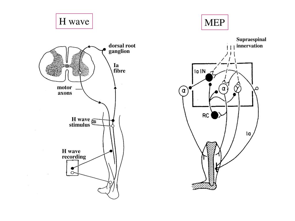 H wave MEP dorsal root ganglion Ia fibre motor axons H wave stimulus