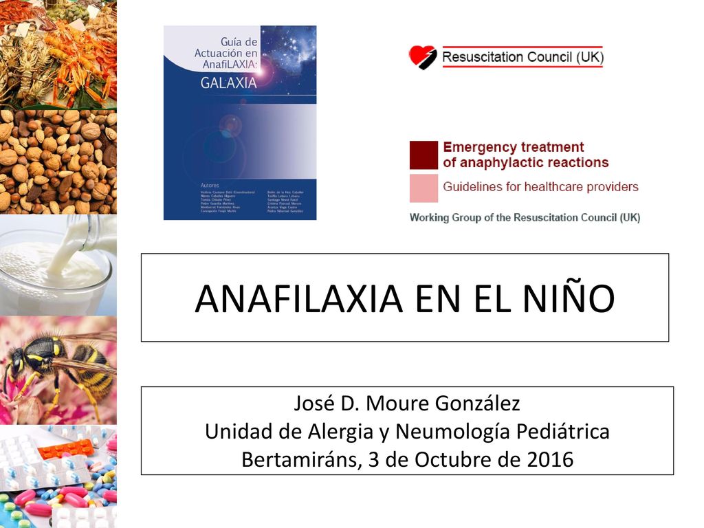 ANAFILAXIA EN EL NIÑO José D. Moure González Unidad de Alergia y Neumología Pediátrica.