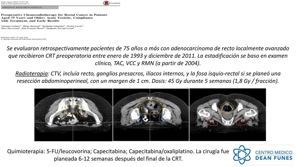 Se evaluaron retrospectivamente pacientes de 75 años o más con adenocarcinoma de recto localmente avanzado que recibieron CRT preoperatoria entre enero de 1993 y diciembre de La estadificación se baso en examen clínico, TAC, VCC y RMN (a partir de 2004).