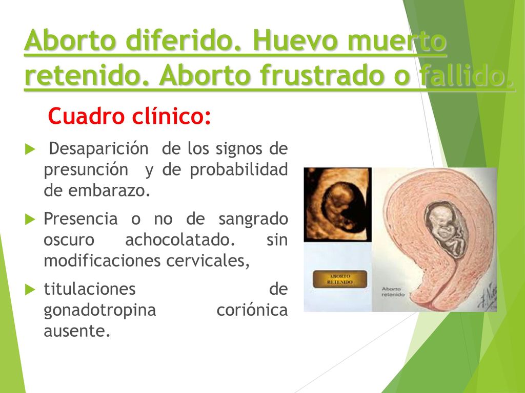 Aborto diferido. Huevo muerto retenido. Aborto frustrado o fallido.