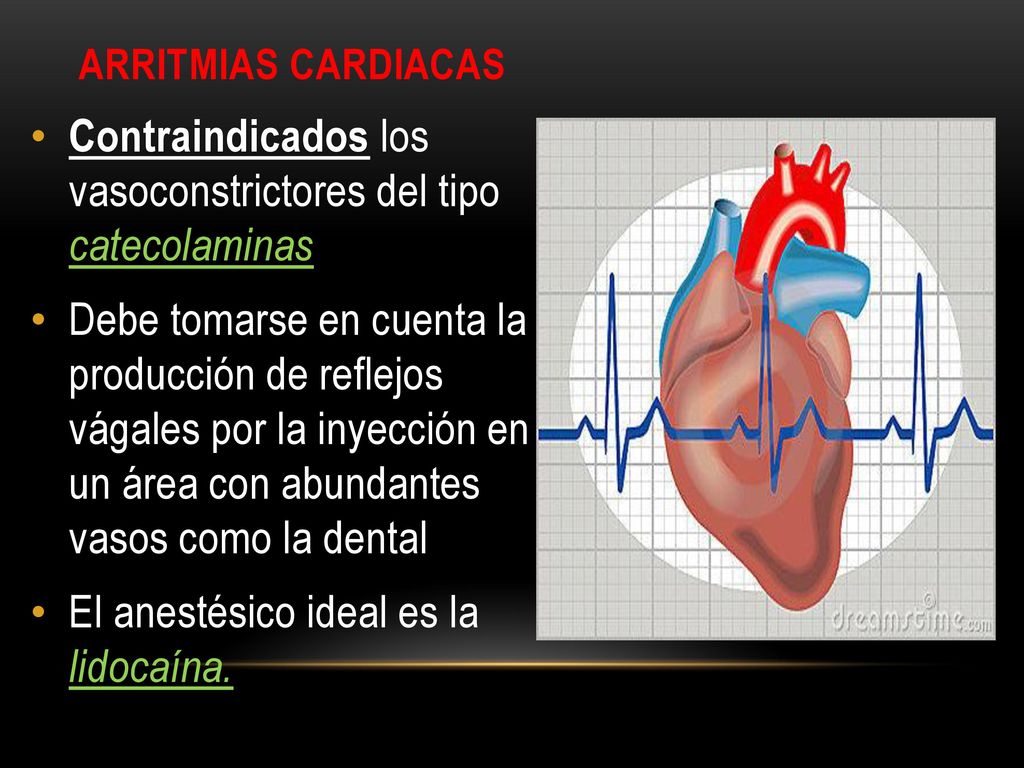 Contraindicados los vasoconstrictores del tipo catecolaminas
